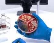 Staphylococcus aureus